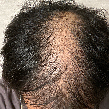 治療前